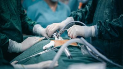 Laparoscopic Hysterectomy & Myomectomy